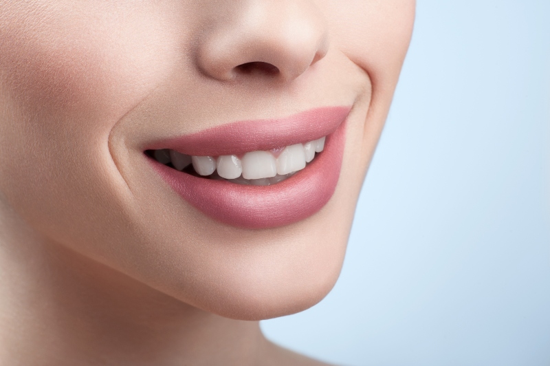 Beneficios del Blanqueamiento Dental