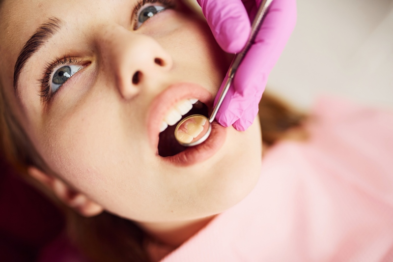 Cómo Prevenir y Tratar las Caries en Niños