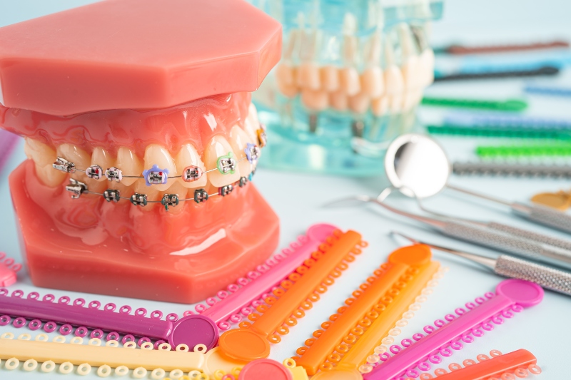 tipos de ortodoncia