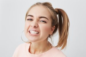 carillas para dientes apiñados