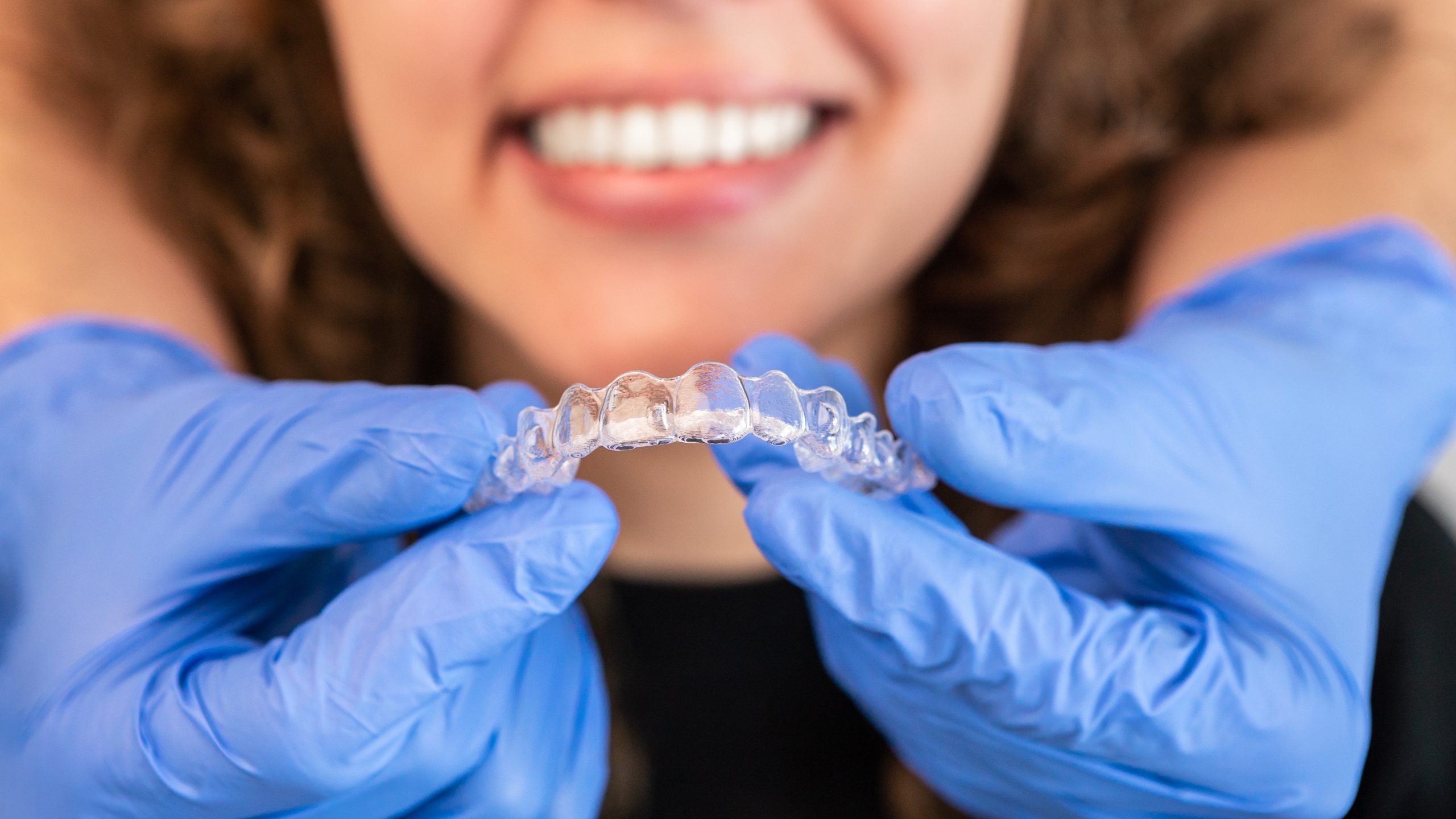 alternativas a los brackets