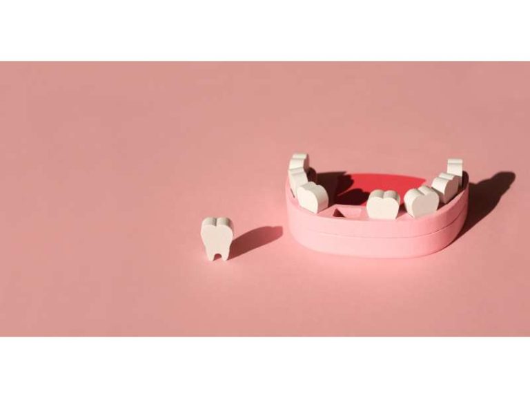 proceso de implantes dentales
